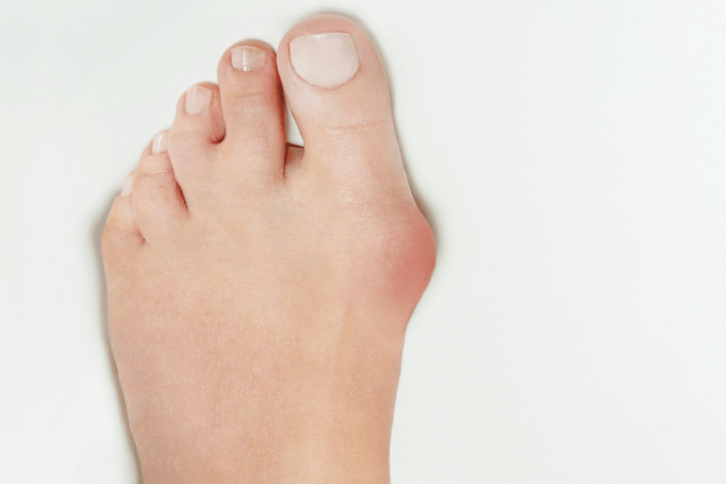 Hallux Splint or Functional Socks? What Customers Should Know Before Buying