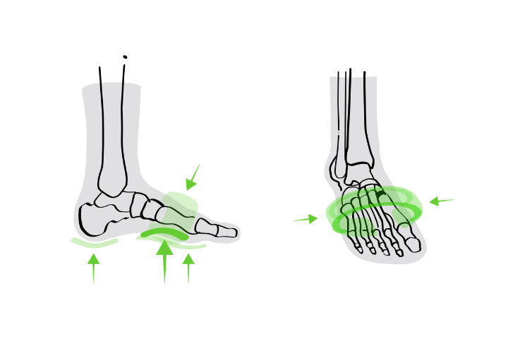 How INFINIRI Supports the Forefoot